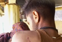 जंगल में बकरी चुगाने गए व्यक्ति पर बाघ ने किया हमला